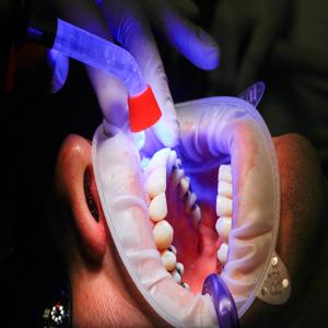 편도결석을 제거하기 위해 필요한 수술 방법은 무엇인가요 What surgical methods are needed to remove tonsil stones