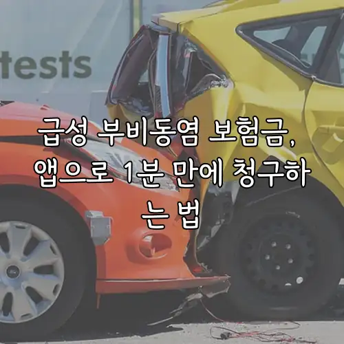 급성 부비동염 보험금, 앱으로 1분 만에 청구하는 법